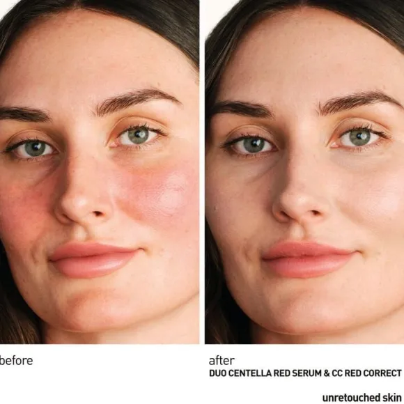 Centella Red Serum - Lugnande koncentrat med omedelbar verkan