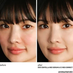 Centella Red Serum - Lugnande koncentrat med omedelbar verkan