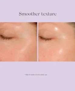 Daily Resurfacing Peel