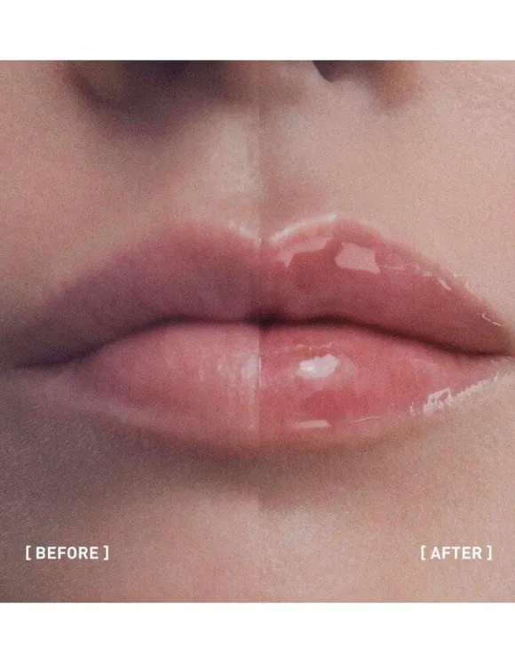 Filorga Hyalu-Filler Lips 4g