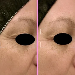 Repair Capsules - Regenererande serum med niacinamid, fotolyas och pep