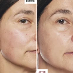 Skin Therapy - Multi-Perfecting Night Oil