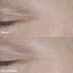 Smart Clinical Repair AM/PM Retinoid Balm