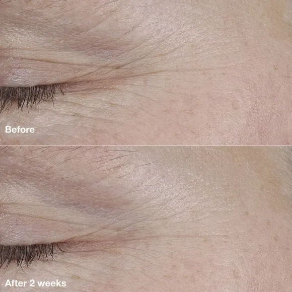 Smart Clinical Repair AM/PM Retinoid Balm