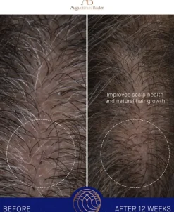 The Leave-In Hair Treatment